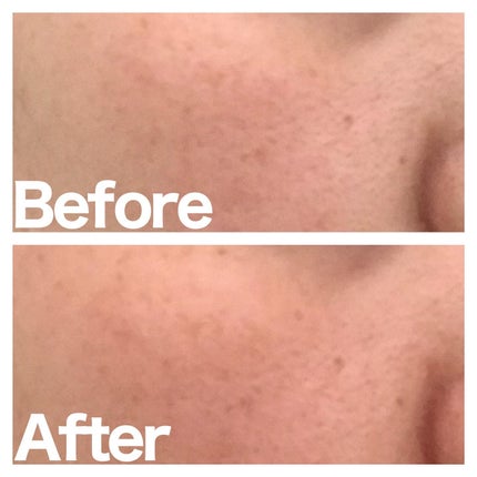 シカクリアトナー/mul clear/化粧水を使ったクチコミ(4枚目)