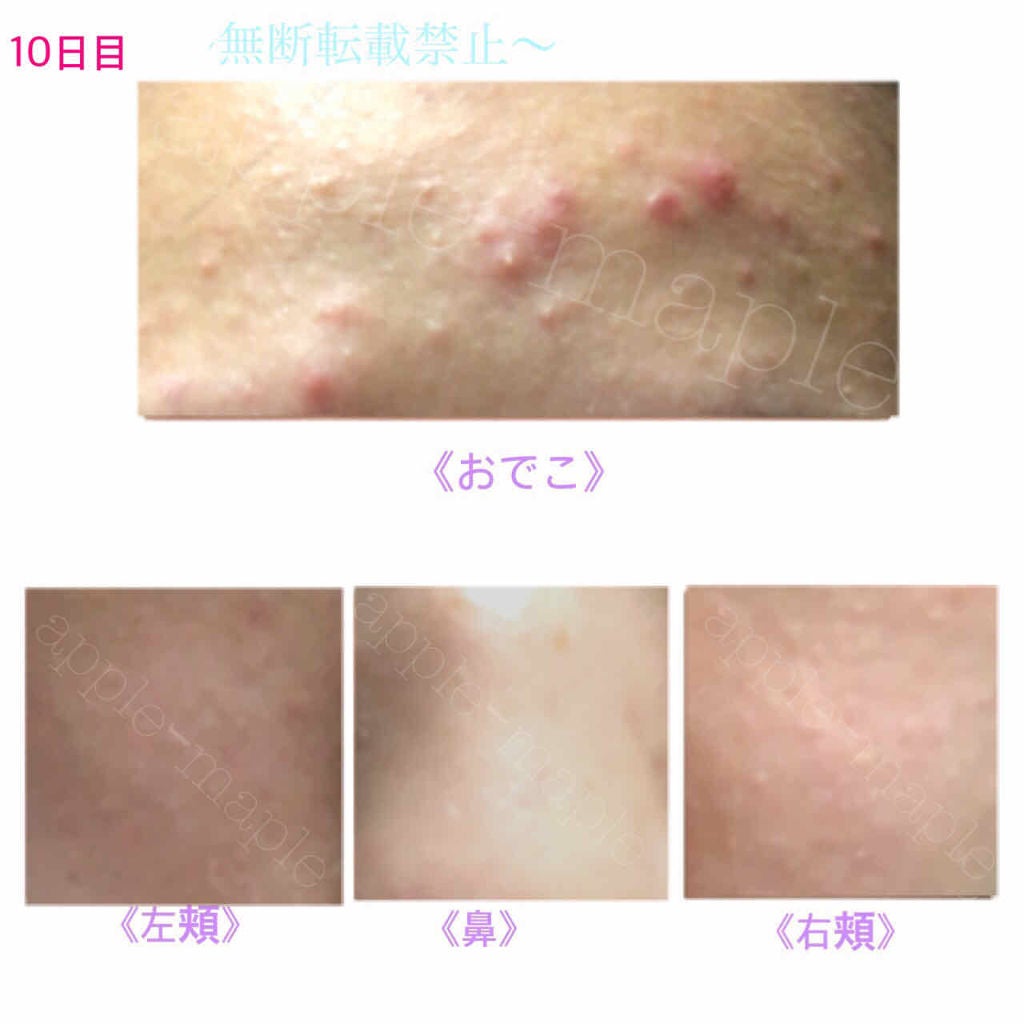 ロゼット 洗顔パスタ 荒性肌/ロゼット/洗顔フォームを使ったクチコミ(4枚目)