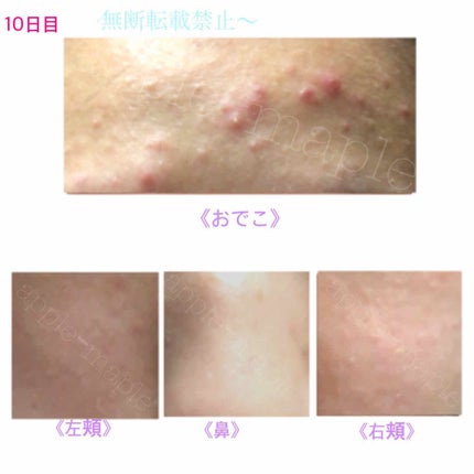 ロゼット 洗顔パスタ 荒性肌/ロゼット/洗顔フォームを使ったクチコミ(4枚目)