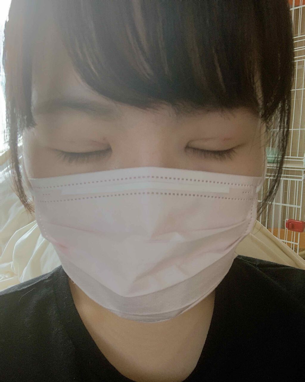 二重整形/その他を使ったクチコミ（2枚目）