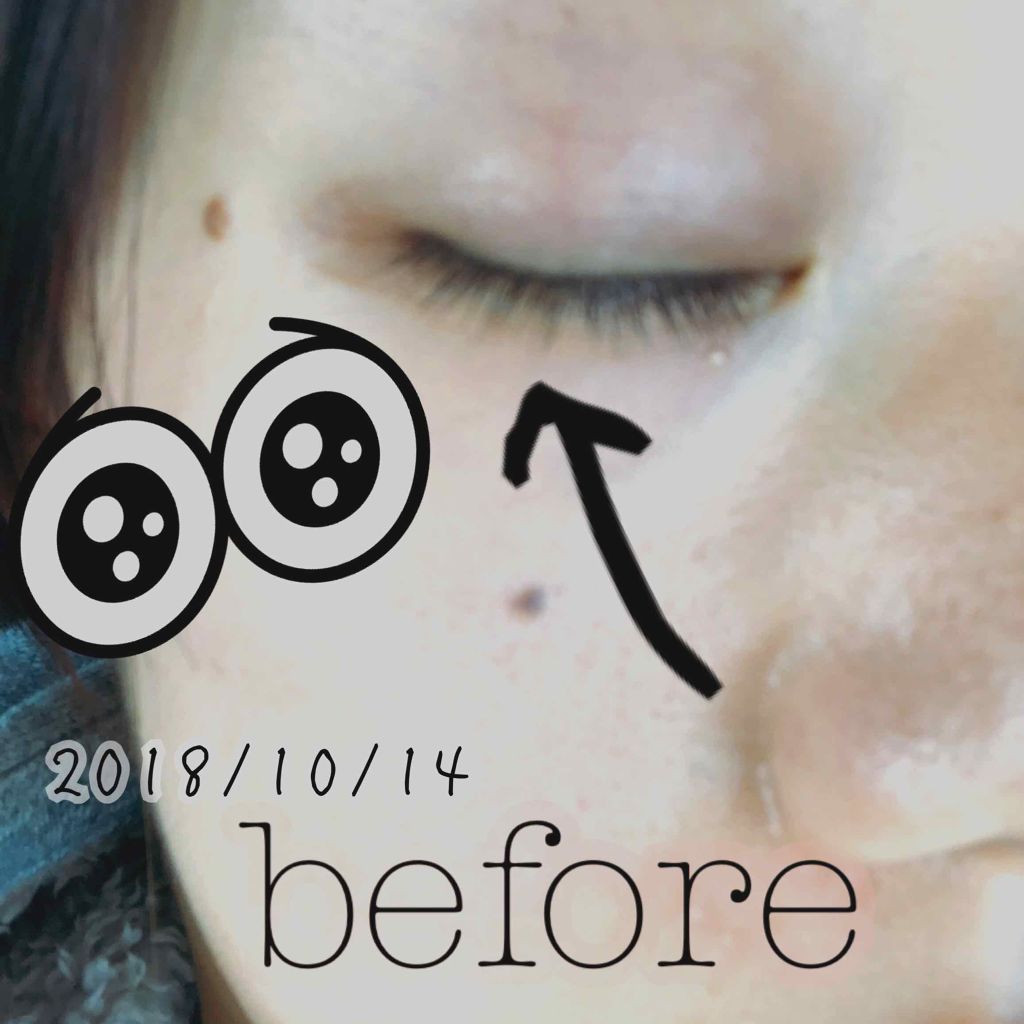 ローヤルゼリー配合 栄養ローション/DAISO/美容液を使ったクチコミ（2枚目）