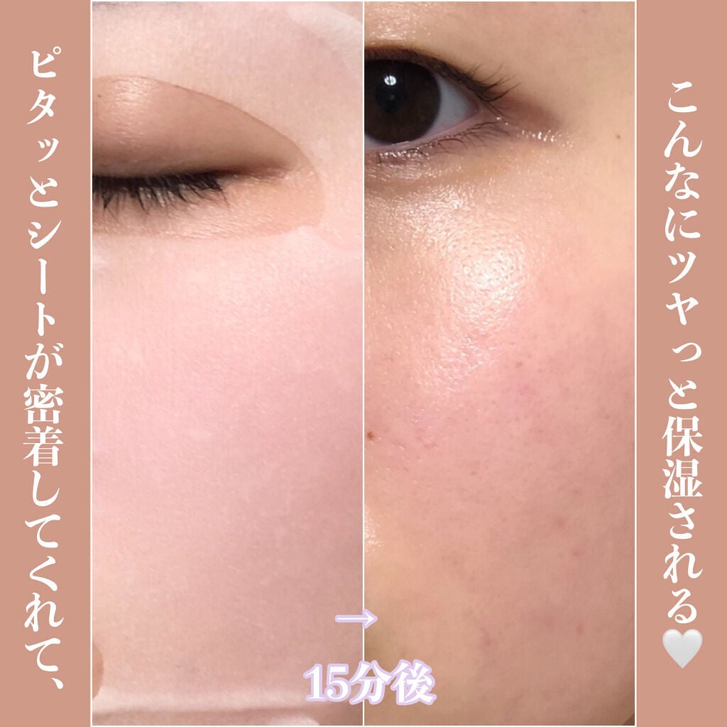 SUIKO HC ビタミン5エッセンスマスク/SUIKO HATSUCURE/シートマスク・パックを使ったクチコミ(4枚目)