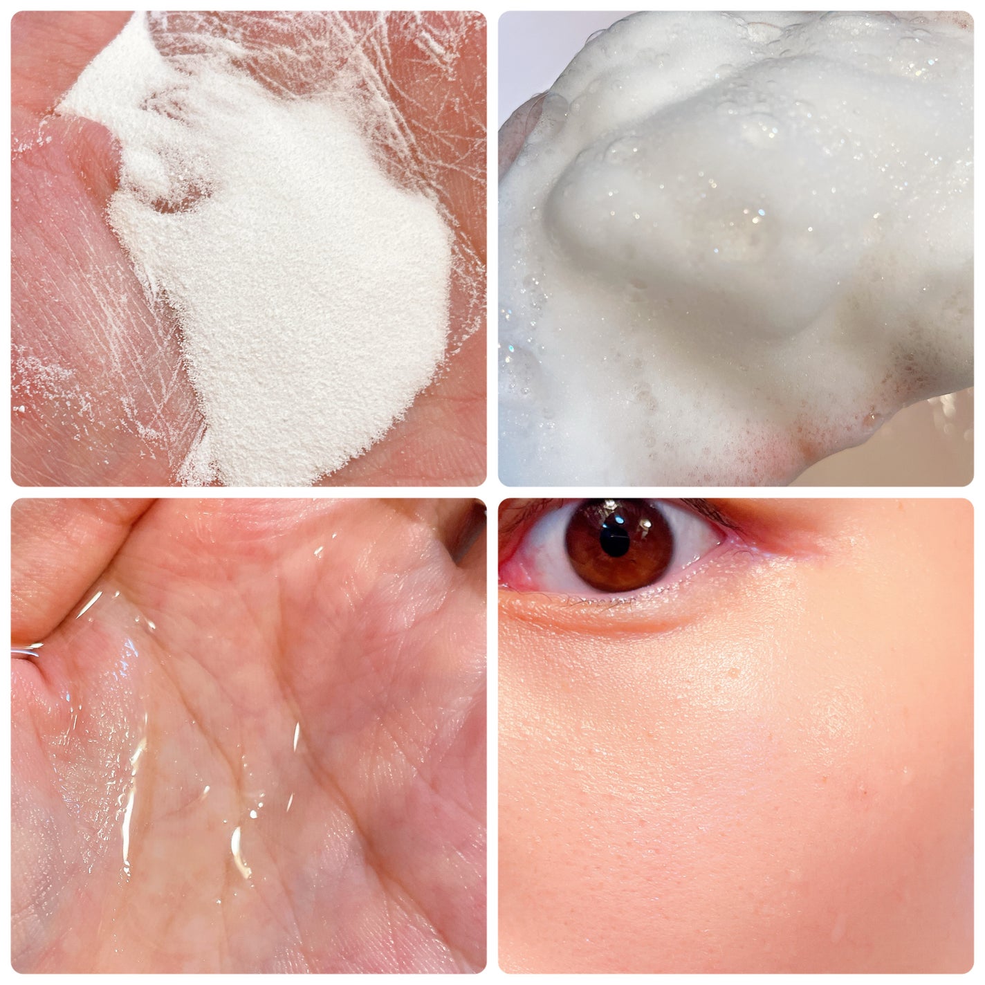 ピールケアオイル/chant a charm /ピーリングを使ったクチコミ(2枚目)