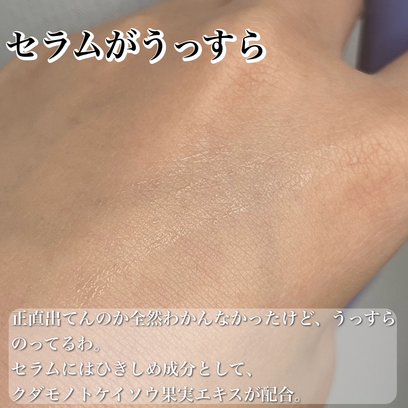 アイトークセラム/アイトーク/アイケア・アイクリームを使ったクチコミ(4枚目)