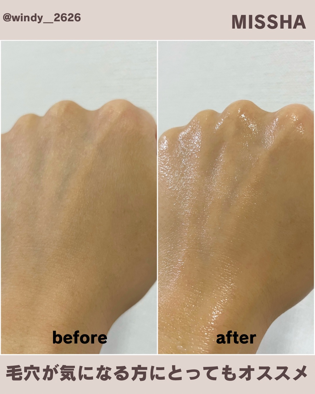 ミシャ ビタシープラス 美容液パッド/MISSHA/トナーパッドを使ったクチコミ（3枚目）