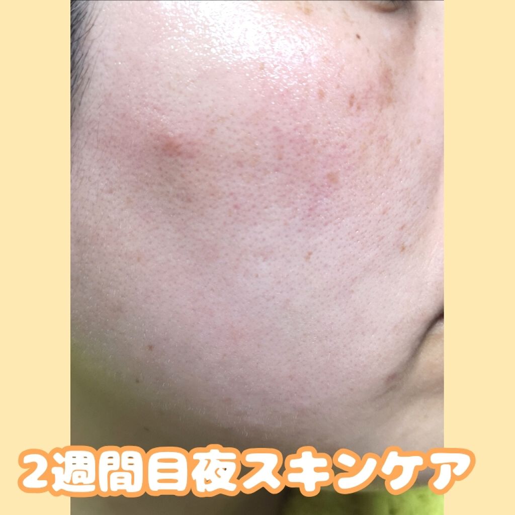 アレルバリア エッセンス BB/d プログラム/BBクリームを使ったクチコミ(4枚目)