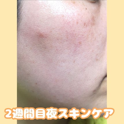 アレルバリア エッセンス BB/d プログラム/BBクリームを使ったクチコミ(4枚目)