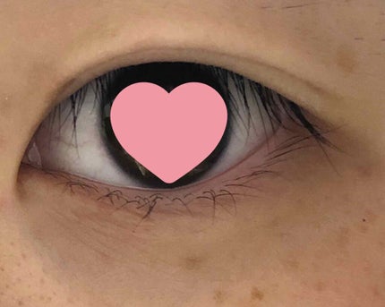 アイビューティー フィクサー WP/アストレア ヴィルゴ/二重まぶた用アイテムを使ったクチコミ(2枚目)