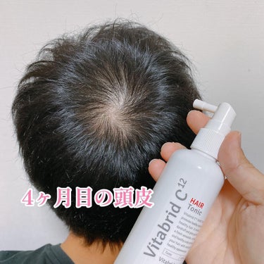 ビタブリッドジャパン ビタブリッドCヘアートニックセットEX 110mg