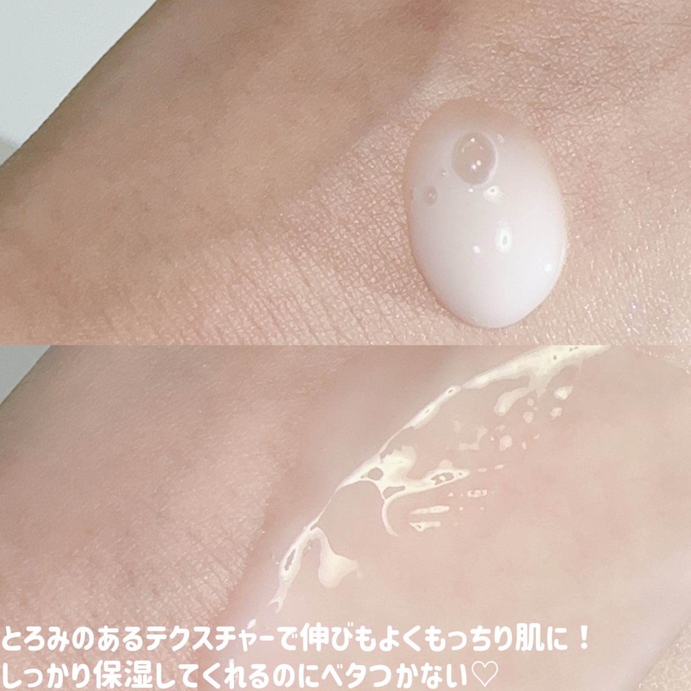 プロバイオシカ インテンシブ アンプル/SKIN1004/美容液を使ったクチコミ(3枚目)