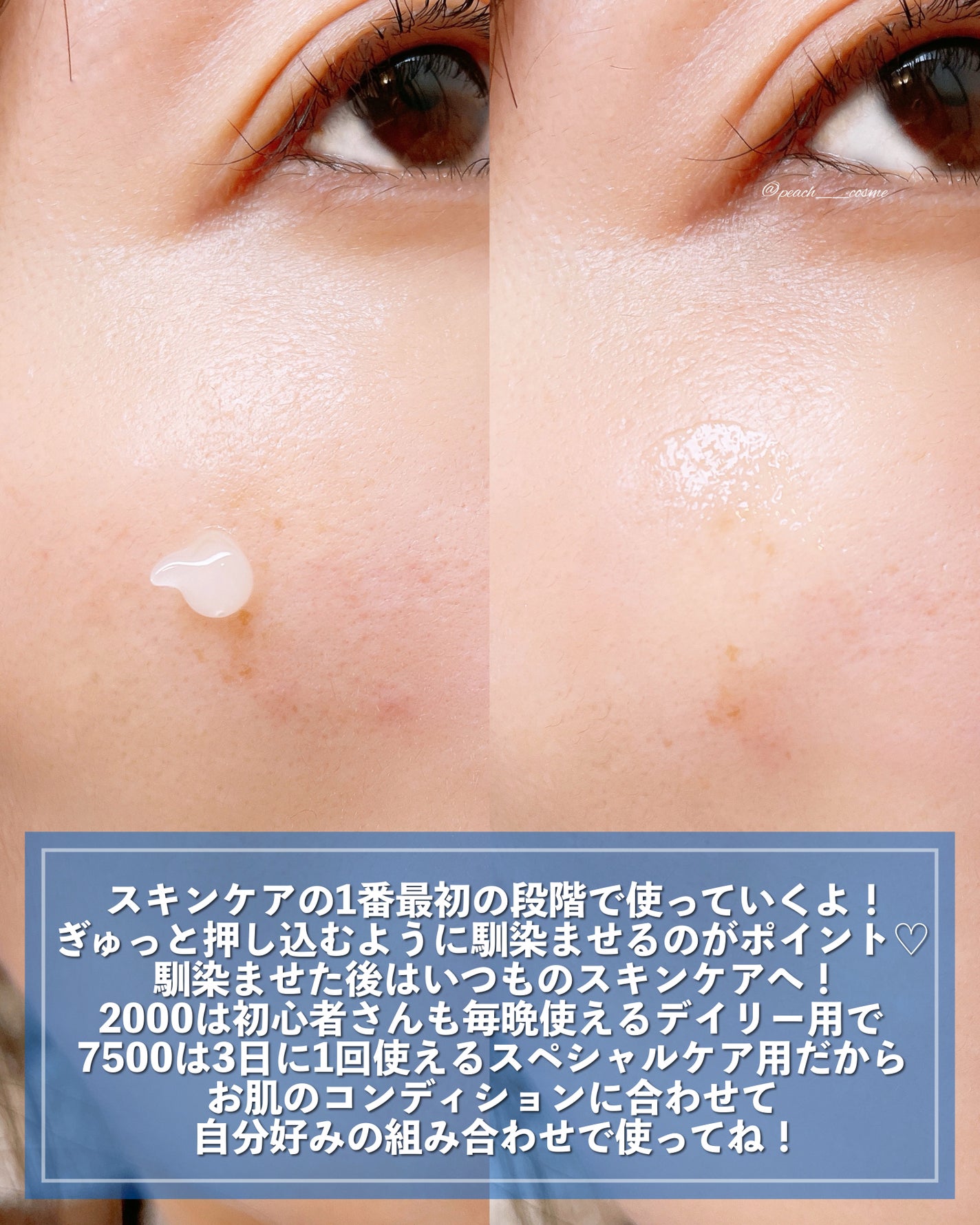 ゼロ1DAYエクソソームショット2000/MEDICUBE/美容液を使ったクチコミ(5枚目)