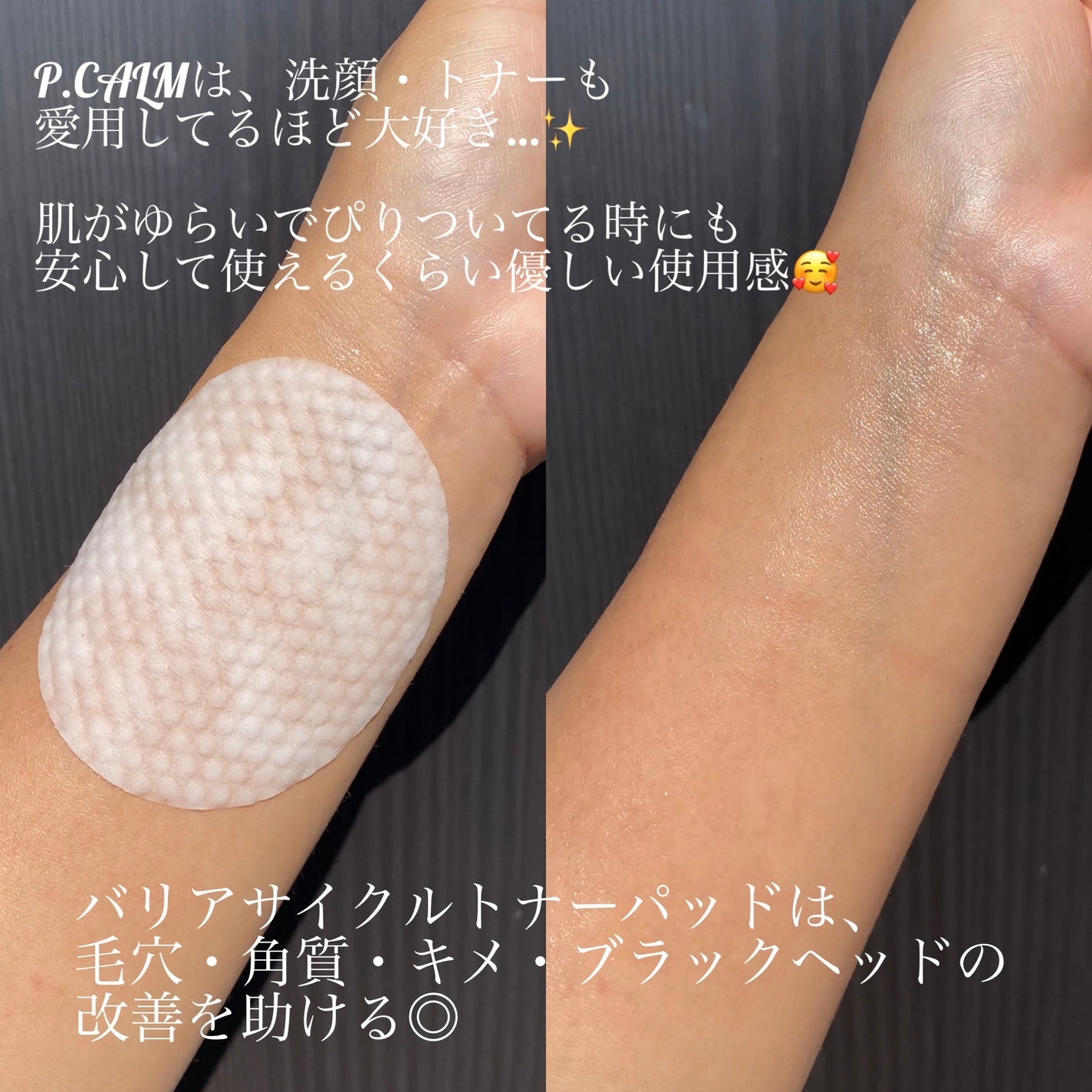 バリアサイクルトナーパッド/P.CALM/トナーパッドを使ったクチコミ(2枚目)