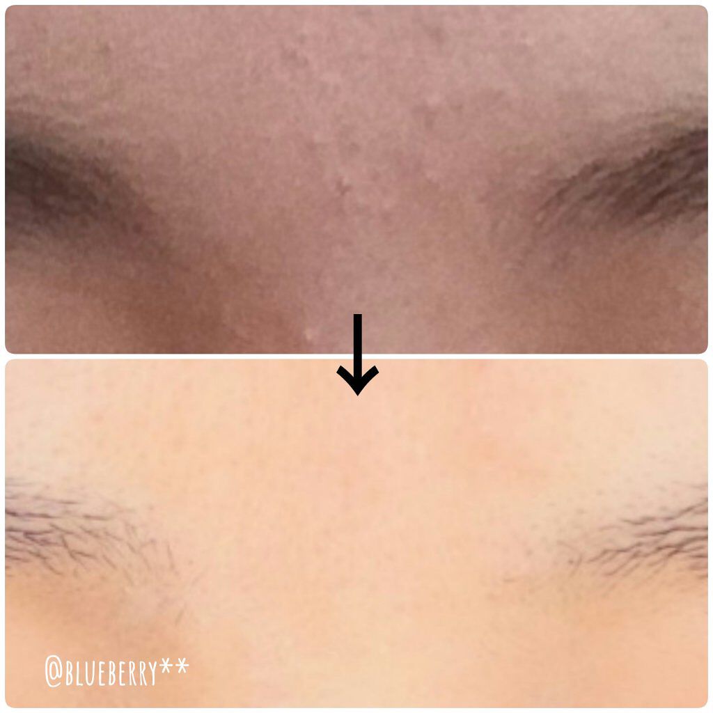 化粧水 敏感肌用 さっぱりタイプ/無印良品/化粧水を使ったクチコミ(3枚目)