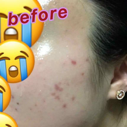 ティーツリーケアソリューション アンプルマスクJEX/MEDIHEAL/シートマスク・パックを使ったクチコミ(2枚目)