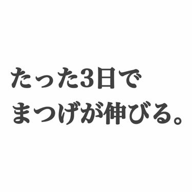 ⚠️3、4枚目にまつげの写真あります


こんにちは、ぢかをです🧸

実は私、まつげが短く、少ないことをコンプレックスとして悩んでいました……。😢
そんなときに!!
LIPSで見かけたDAISOのRJロ