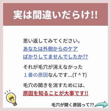 あなたの肌に合ったスキンケア💐コーくん on LIPS 「【本当は教えたくない。】毛穴の開きエグい消える方法。..あなた..」（4枚目）