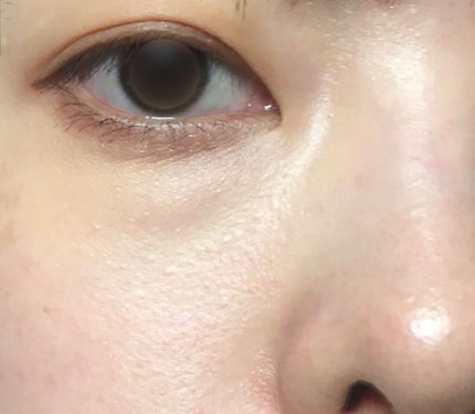 ミネラルコンシーラーパレット/エトヴォス/パレットコンシーラーを使ったクチコミ(4枚目)