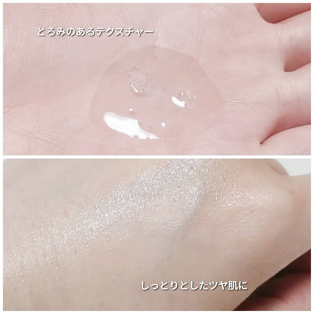 バイタルアクト ローション MB 本体/d プログラム/化粧水を使ったクチコミ（3枚目）