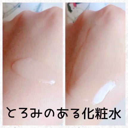 モイスチュア ローション/カルテHD/化粧水を使ったクチコミ(4枚目)