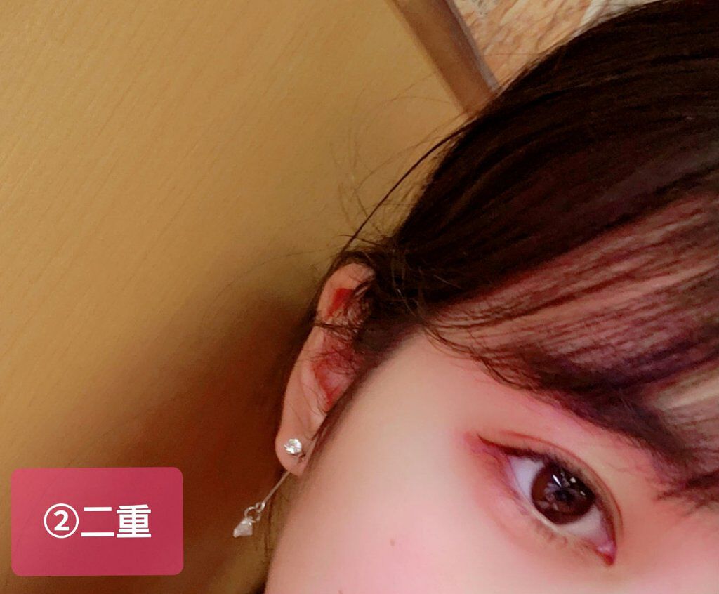 アイトーク/アイトーク/二重まぶた用アイテムを使ったクチコミ（3枚目）
