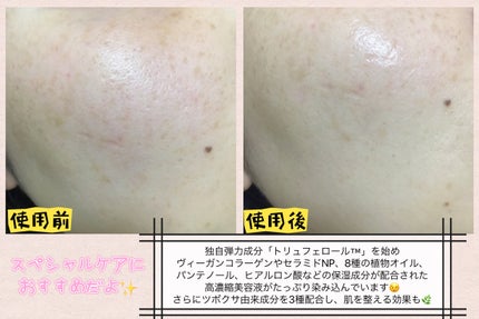 インテンシブリフテンションマスク/ダルバ/シートマスク・パックを使ったクチコミ(4枚目)