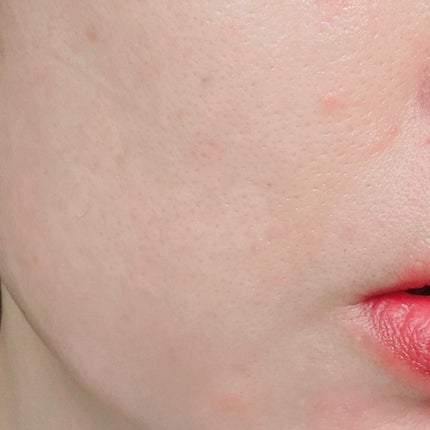 アミノ酸トナー/dixionist/化粧水を使ったクチコミ(8枚目)