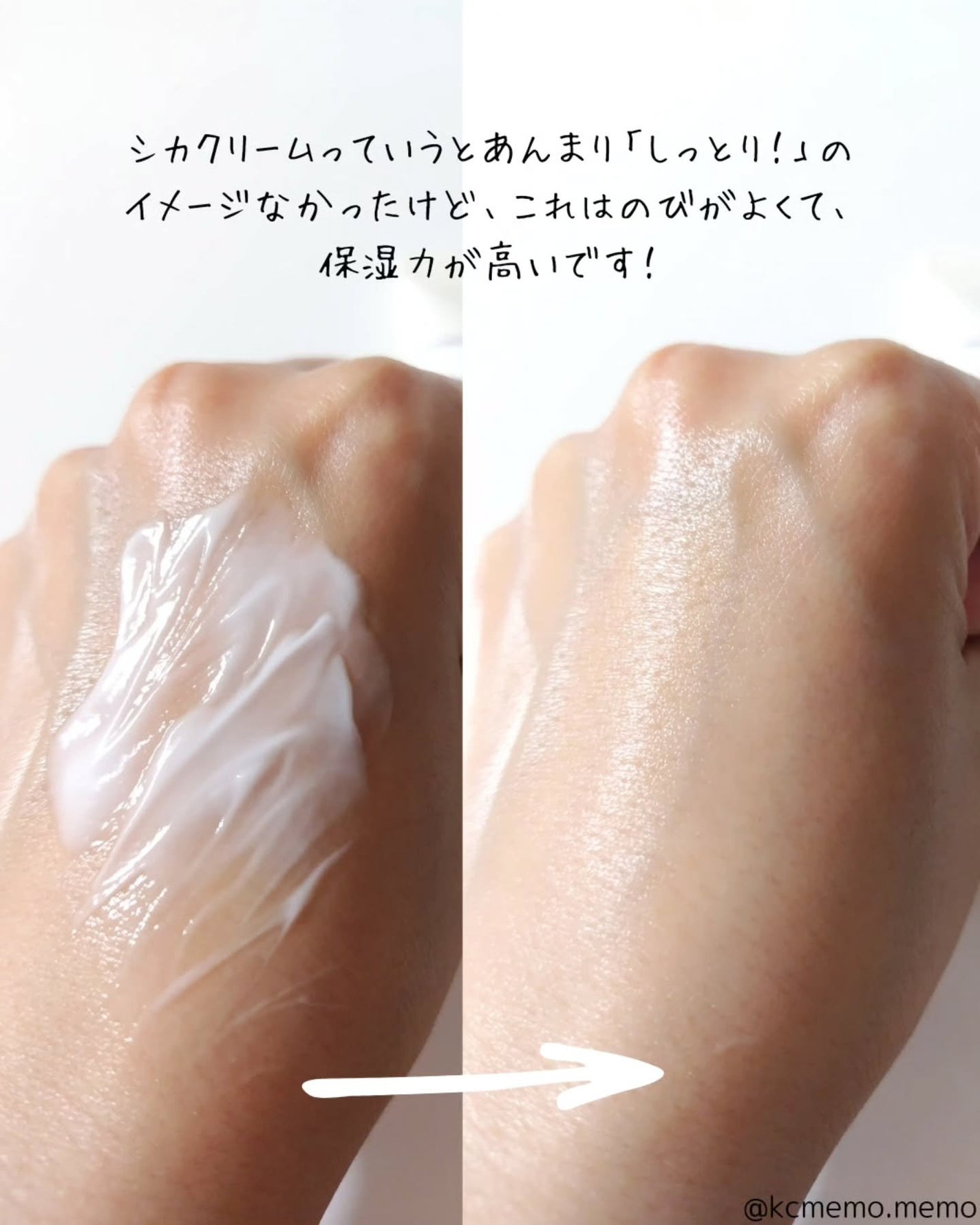 DW-EGFワンデイズアンプル/Easydew/美容液を使ったクチコミ(8枚目)