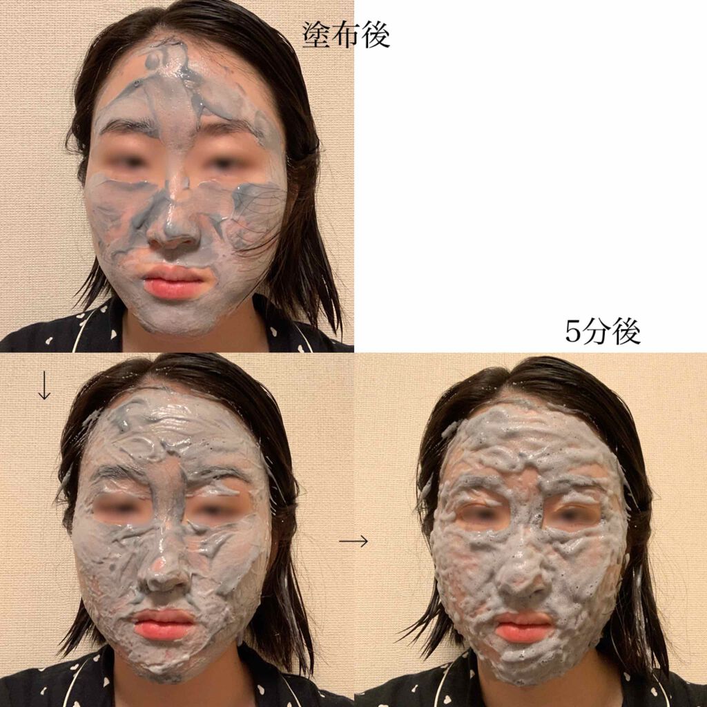 バブルクレイパック/イエスパ/洗い流すパック・マスクを使ったクチコミ（3枚目）