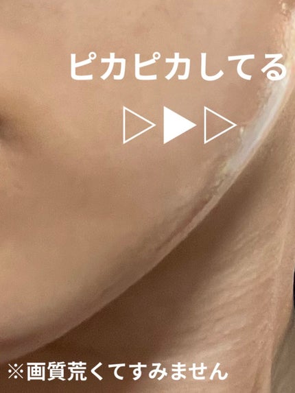 ももぷり フレッシュピールオフパック/ももぷり/ピーリングを使ったクチコミ(2枚目)
