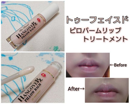~トゥー フェイスド ハングオーバー~ ピロー バーム リップ トリートメント/Too Faced/リップ美容液を使ったクチコミ(1枚目)