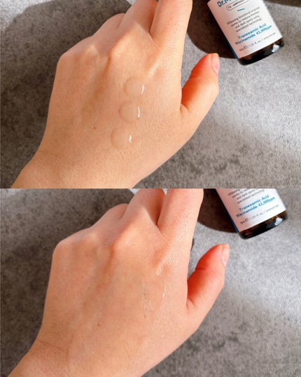 TX-Cream/Dr.Melaxin/フェイスクリームを使ったクチコミ(4枚目)