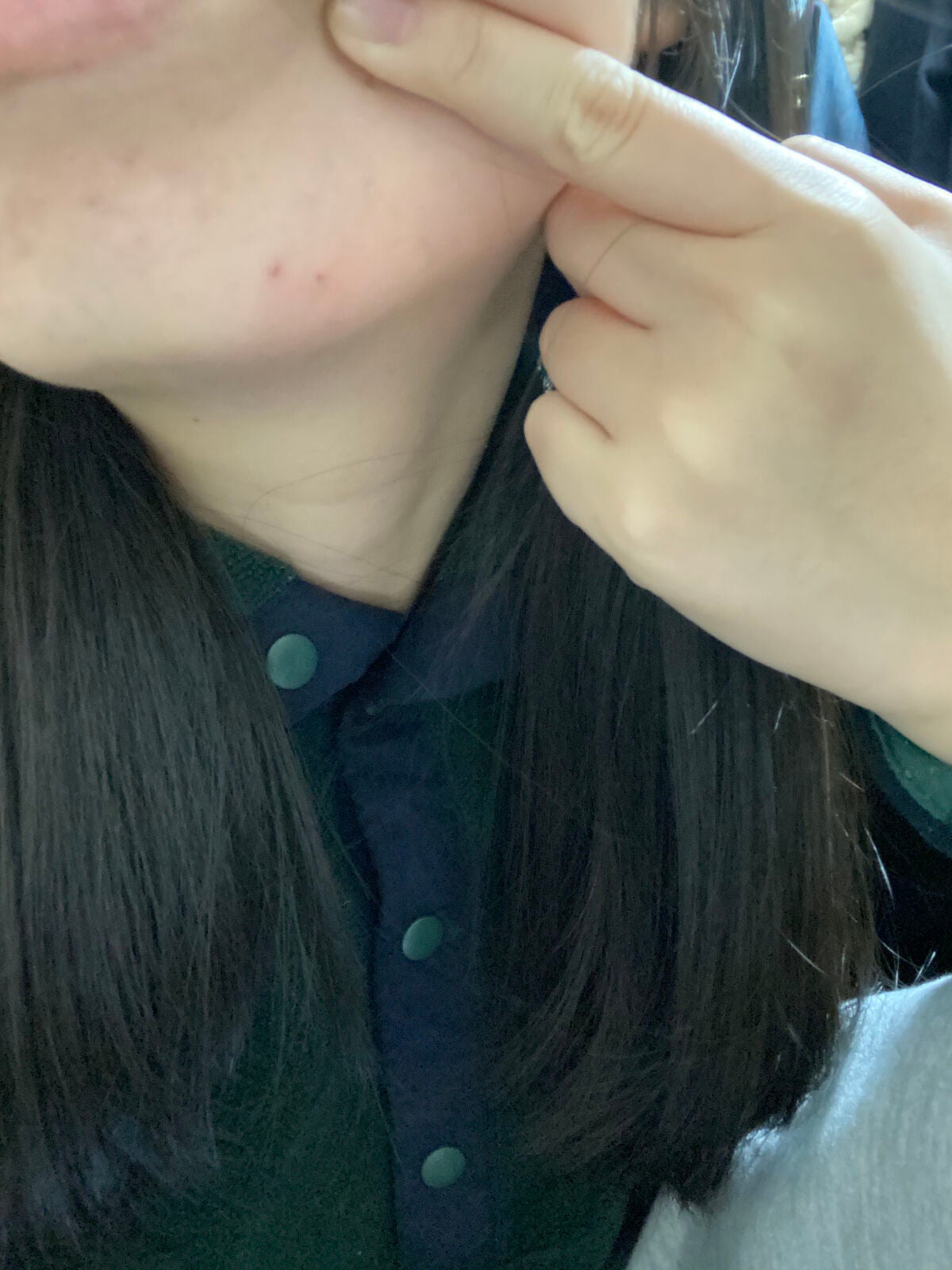 うか on LIPS 「助けてください。今ストレスがやばい、生理が被ってる、乾燥やばい..」(3枚目)