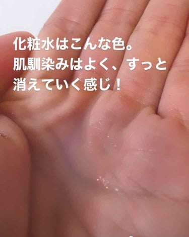 薬用化粧水/スキンライフ/化粧水を使ったクチコミ（3枚目）