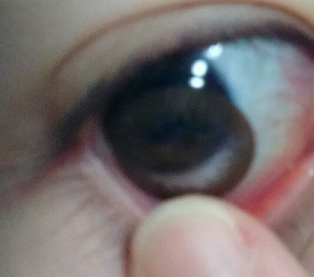 ワンデーアキュビュー®ディファイン®モイスト®/アキュビュー® ディファイン®/ワンデー(1DAY)カラコンを使ったクチコミ(4枚目)