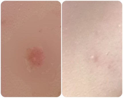 化粧水・敏感肌用・高保湿タイプ/無印良品/化粧水を使ったクチコミ(4枚目)