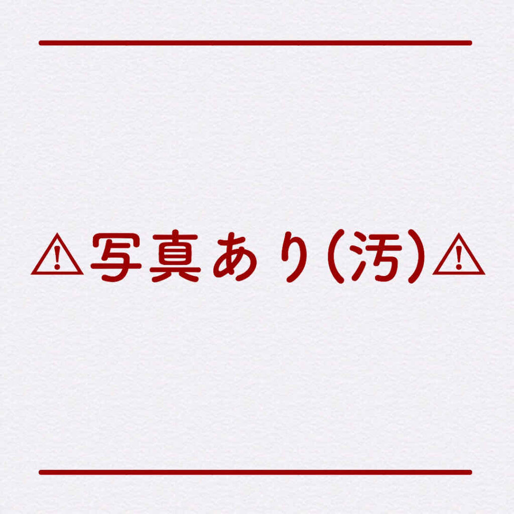 Richesse9 IPL光脱毛器/Richesse9(リシェスナイン)/家庭用脱毛器を使ったクチコミ（2枚目）