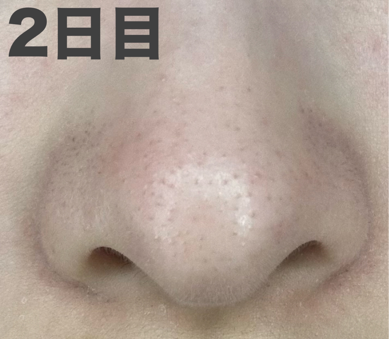 アンドハニー クレンジングバーム ブラック ミニサイズ 20g/&honey/クレンジングバームを使ったクチコミ（3枚目）