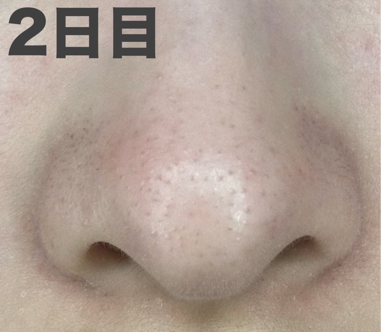 アンドハニー クレンジングバーム ブラック/&honey/クレンジングバームを使ったクチコミ(3枚目)