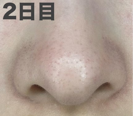 アンドハニー クレンジングバーム ブラック/&honey/クレンジングバームを使ったクチコミ(3枚目)