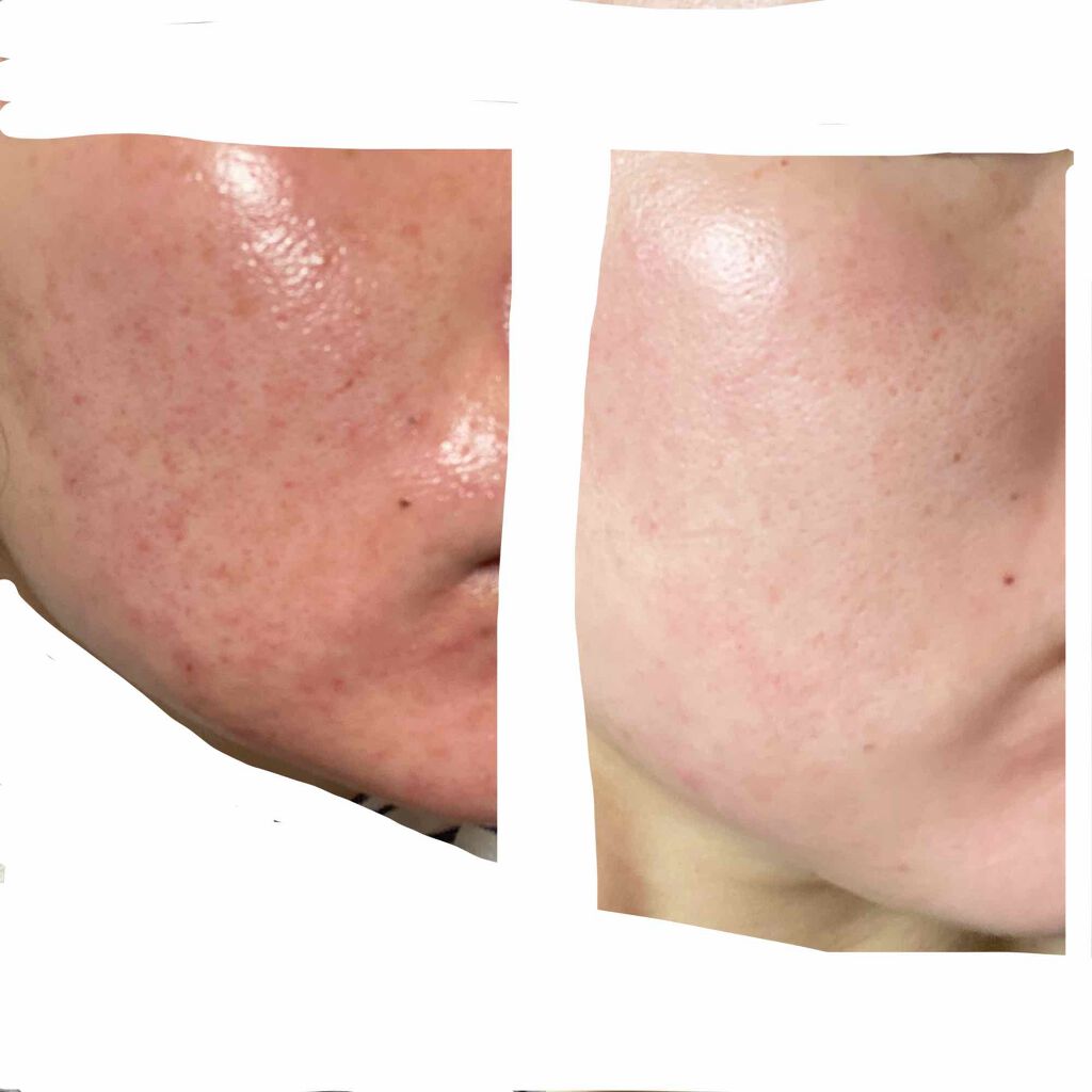 ハトムギ ボディローション/麗白/ボディローションを使ったクチコミ(3枚目)