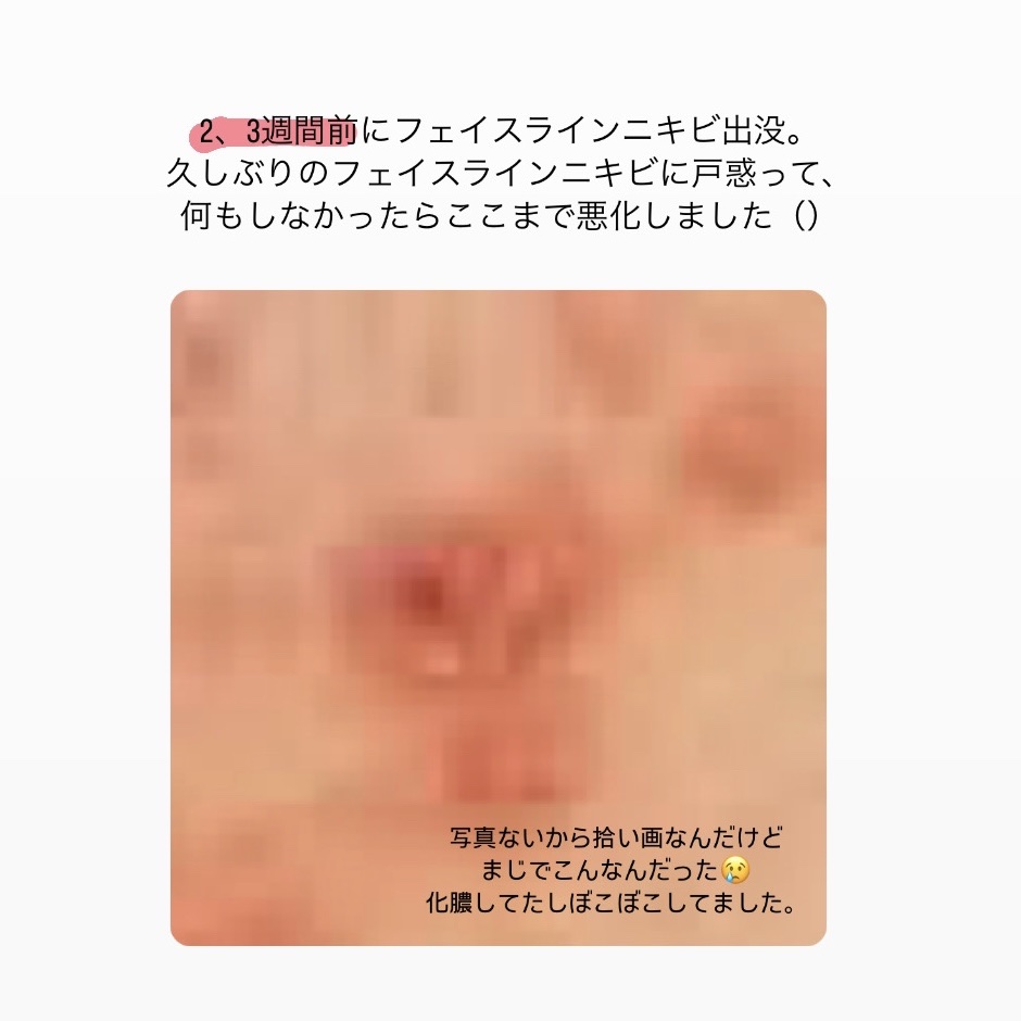 白潤プレミアム 薬用浸透美白化粧水(しっとりタイプ)/肌ラボ/化粧水を使ったクチコミ（2枚目）