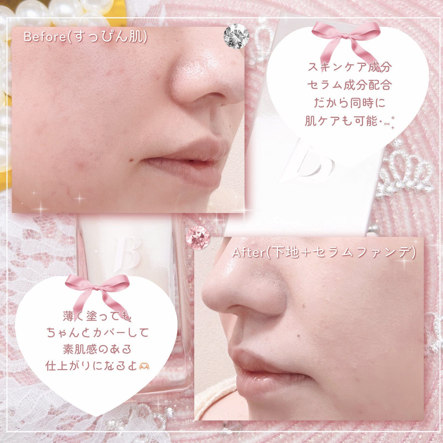 カバーリシャスセラムファンデーション/BANILA CO/リキッドファンデーションを使ったクチコミ(5枚目)