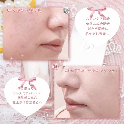 カバーリシャスセラムファンデーション/BANILA CO/リキッドファンデーションを使ったクチコミ(5枚目)