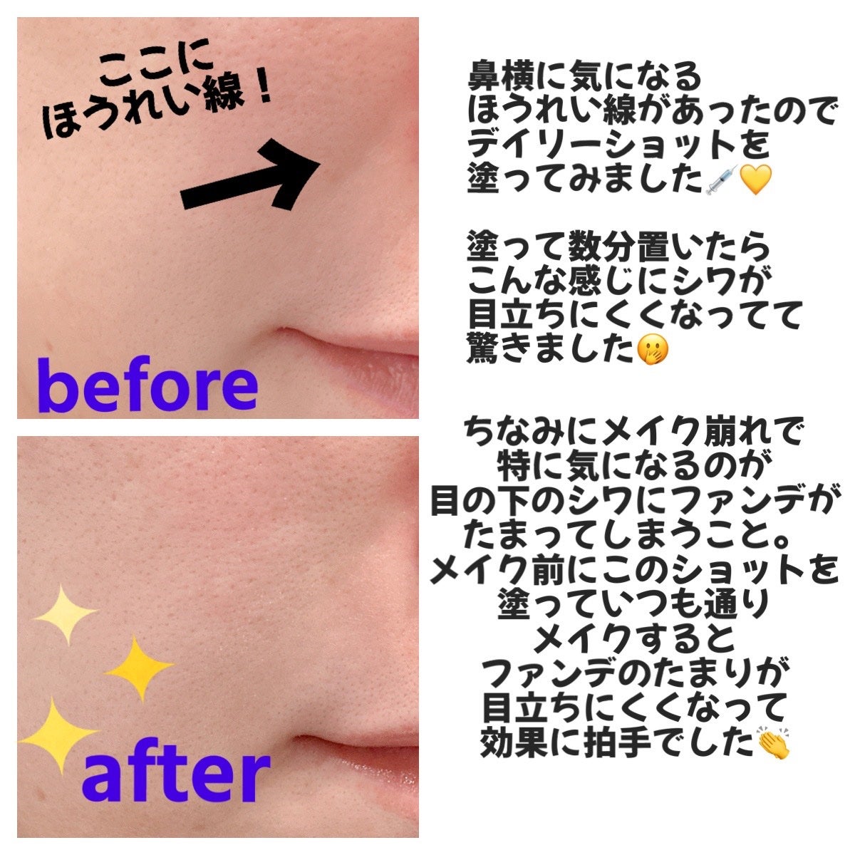 ビトック フォー デイリー RX/Differ&Deeper/美容液を使ったクチコミ(4枚目)