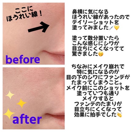 ビトック フォー デイリー RX/Differ&Deeper/美容液を使ったクチコミ(4枚目)