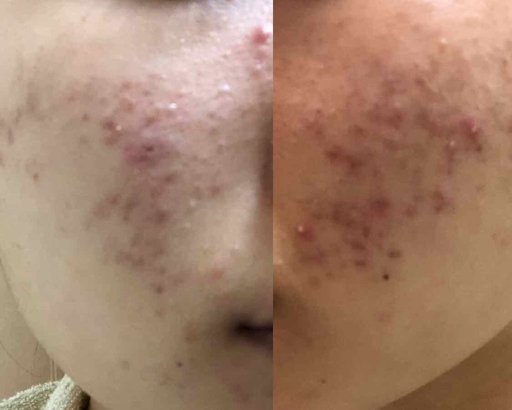 ドクタージャルト シカペアセラム /Dr.Jart+/美容液を使ったクチコミ(4枚目)