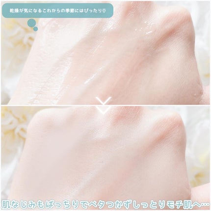 レッドブレミッシュ クリアモイスチャークリーム/Dr.G/フェイスクリームを使ったクチコミ(4枚目)