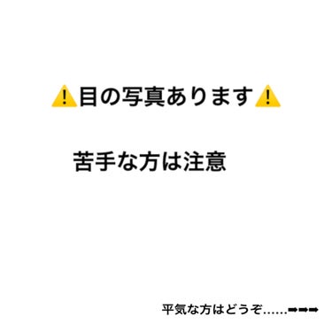 メッシュシートでこっそりふたえ/セリア/二重まぶた用アイテムを使ったクチコミ（2枚目）