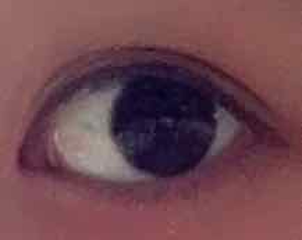 アイビューティー フィクサー WP/アストレア ヴィルゴ/二重まぶた用アイテムを使ったクチコミ(1枚目)