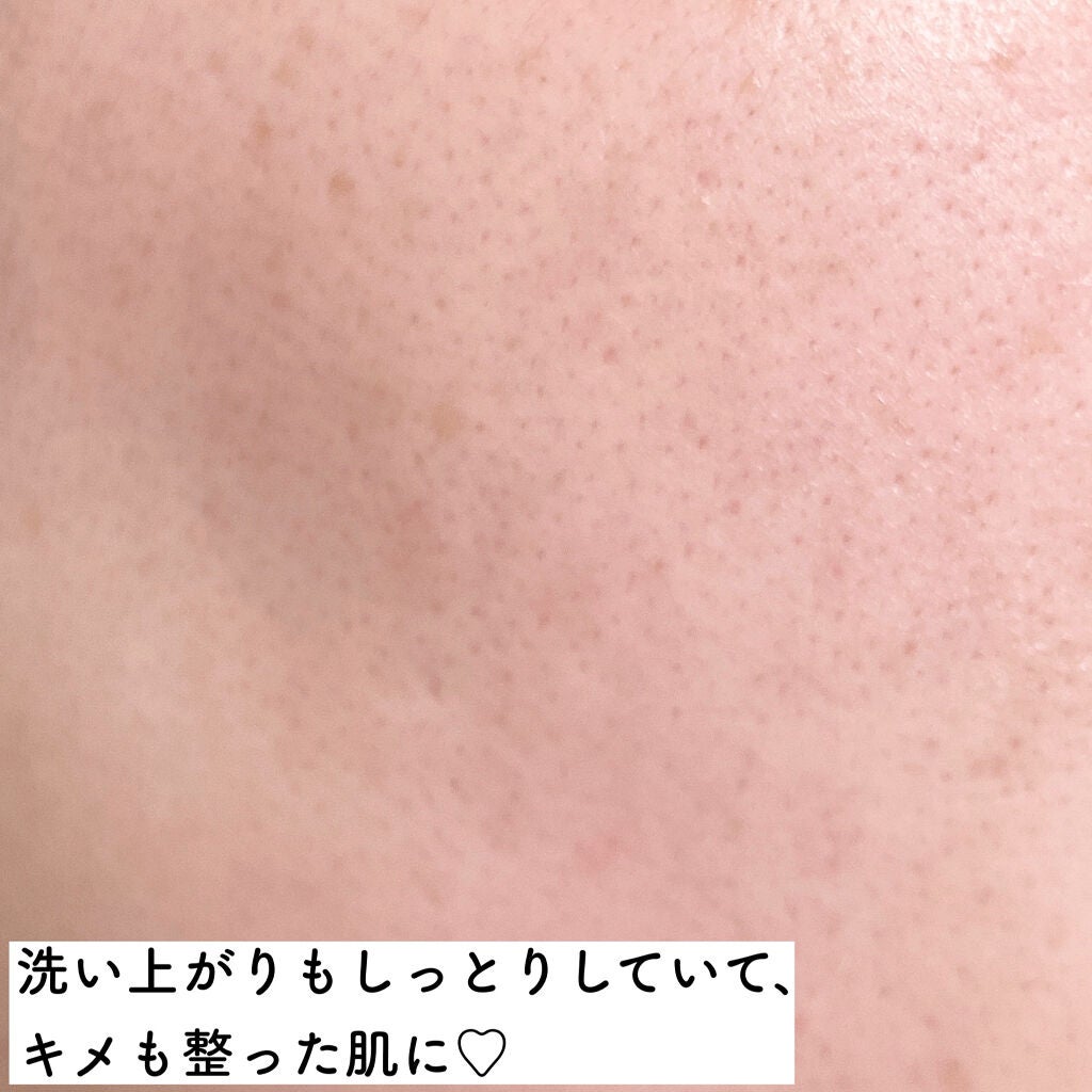 エッセンシャルジェル/Koo/マッサージクリームを使ったクチコミ(5枚目)